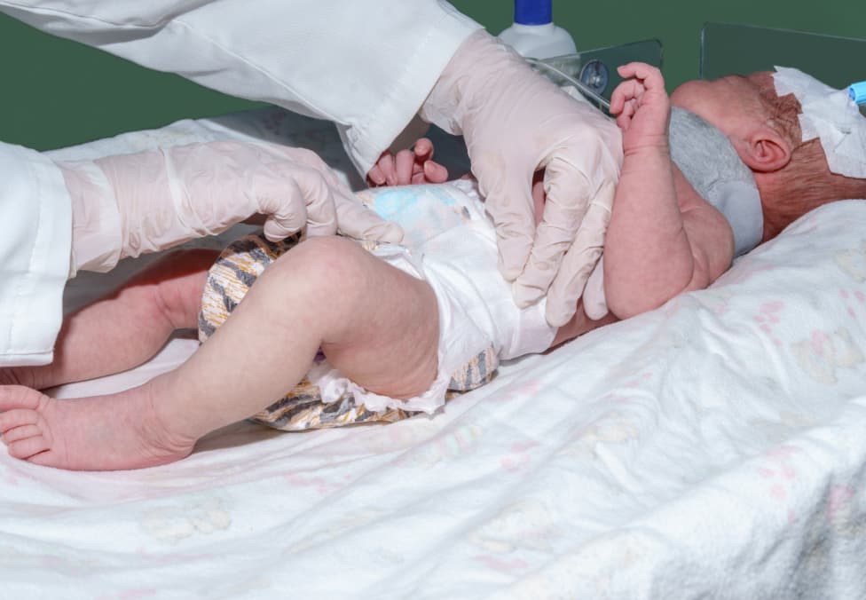 birth-injuries-cases